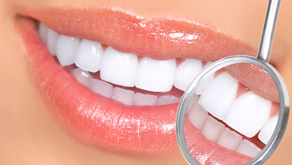 Close-up of a healthy white smile being evaluated with a dental mirror at our Costa Mesa office